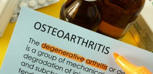 Disability Tax Credit for Canadians Suffering of Arthritis