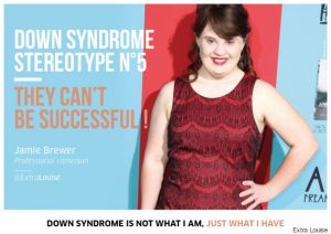 Beyond The Stereotype The Reality Of Being Thin With Down Syndrome - 9bbpb5y